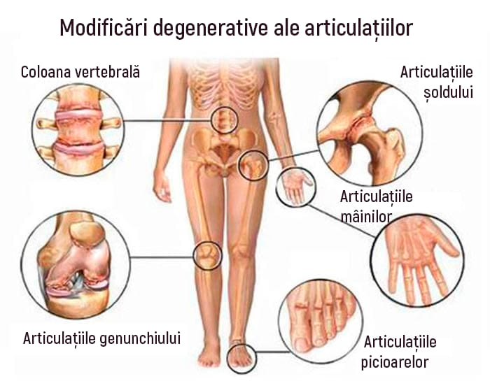 boli ale articulațiilor picioarelor la om
